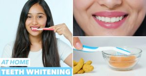 How to get rid of yellow teeth