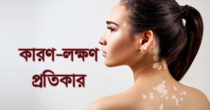 White Patches On Skin